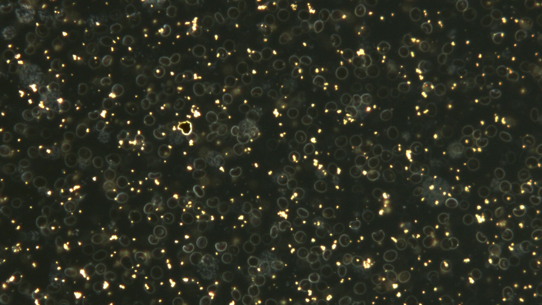 Darkfield assay image showing bright nanoparticle signals among sample features